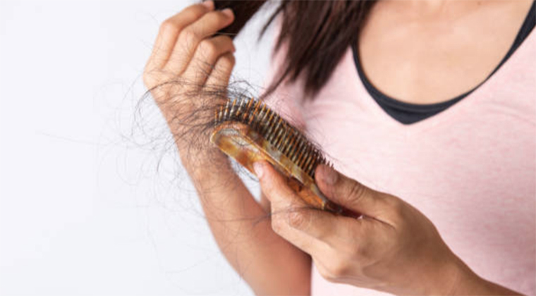 5 Reasons You Should See a Dermatologist About Your Hair Loss